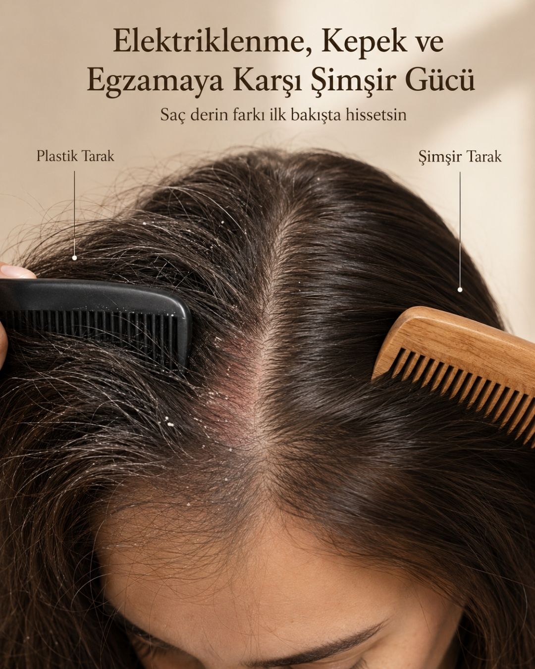 Kepek, Egzama, Sedef ve Saç Derisi Problemleri Azalt | Doğal Şimşir Tarak